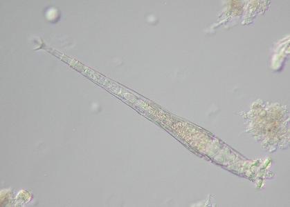 ロタリアの顕微鏡画像