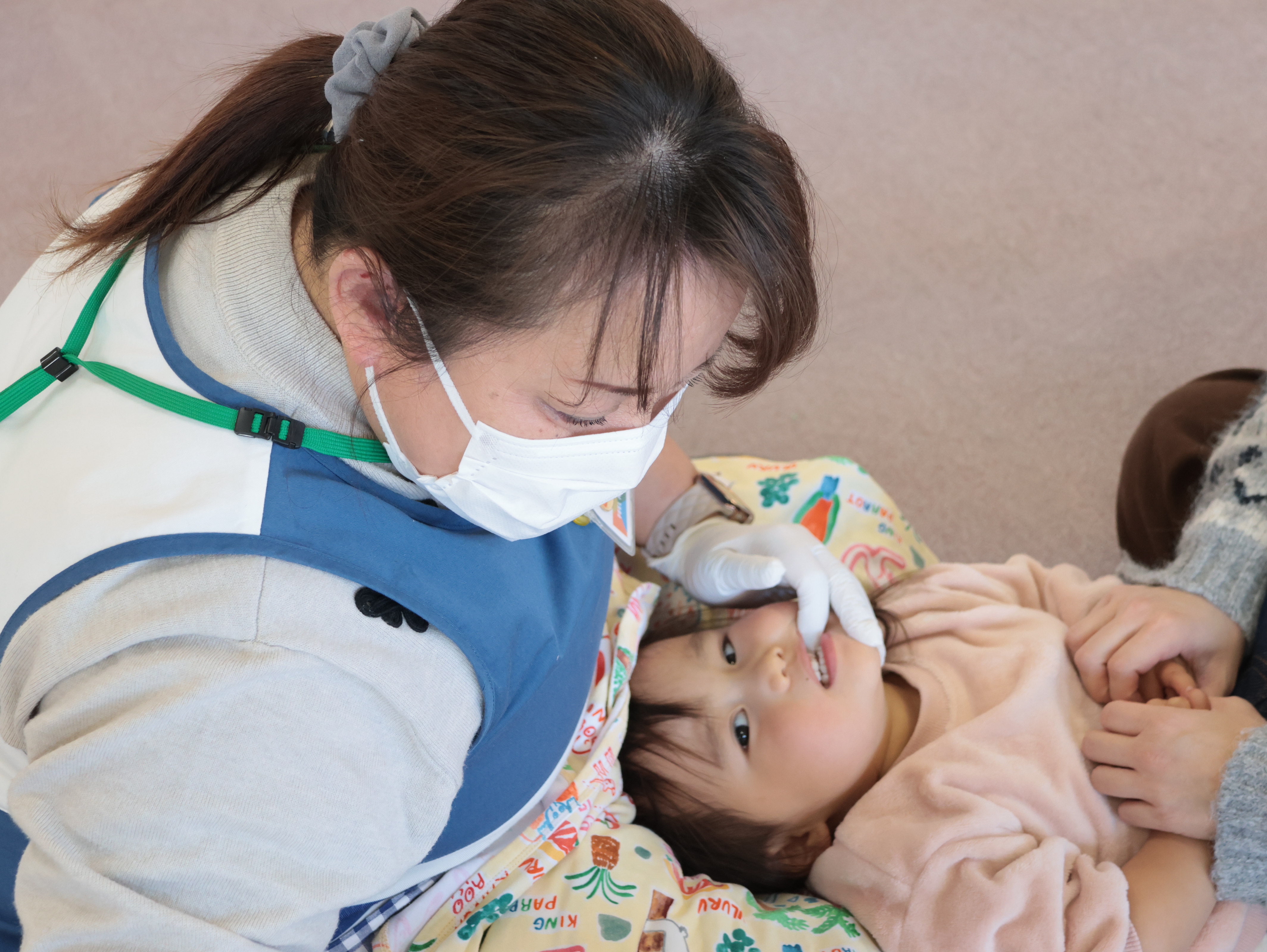 虫歯予防にフッ化物を塗っているところの写真