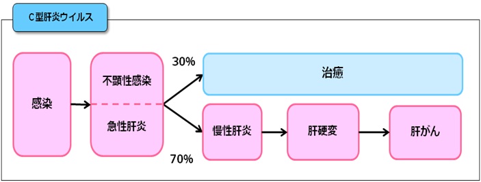 C型肝炎